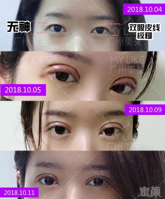 https://img.miyanlife.com/mnt/timg/191015/104J31051-17.jpg