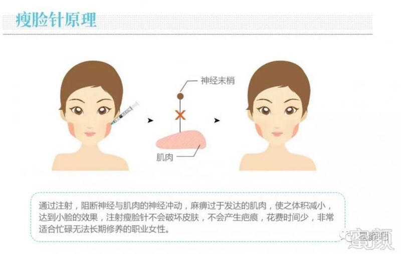 https://img.miyanlife.com/mnt/timg/191016/1235524138-5.jpg
