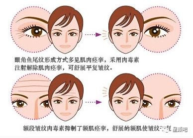https://img.miyanlife.com/mnt/timg/191016/1235543119-6.jpg