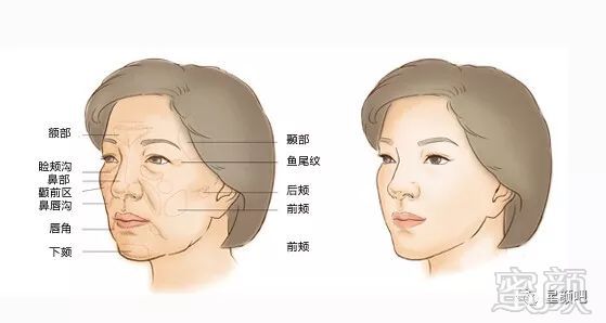 https://img.miyanlife.com/mnt/timg/191016/1235553934-8.jpg
