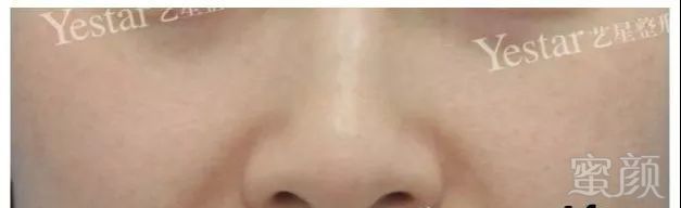 https://img.miyanlife.com/mnt/timg/191018/1222021P4-7.jpg