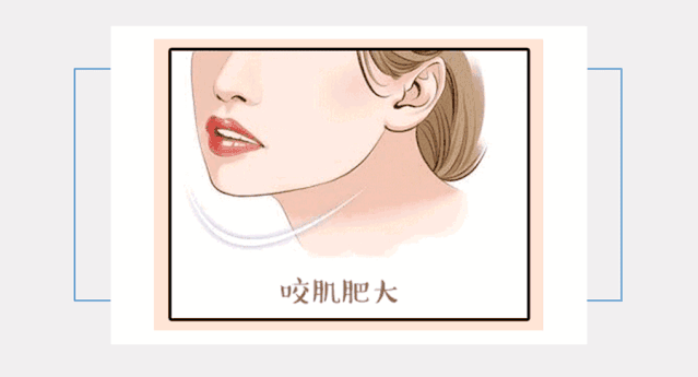 https://img.miyanlife.com/mnt/timg/191018/125T35195-3.jpg