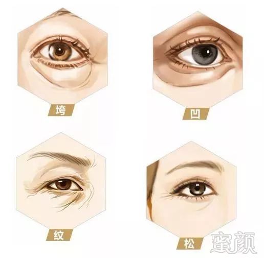 https://img.miyanlife.com/mnt/timg/191018/130F040T-3.jpg