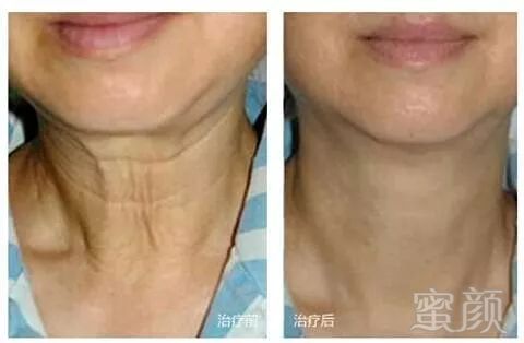 https://img.miyanlife.com/mnt/timg/191018/130F3Nc-8.jpg