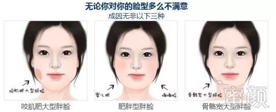 https://img.miyanlife.com/mnt/timg/191019/11364Q2b-1.jpg