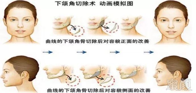 https://img.miyanlife.com/mnt/timg/191019/11364a4M-2.jpg
