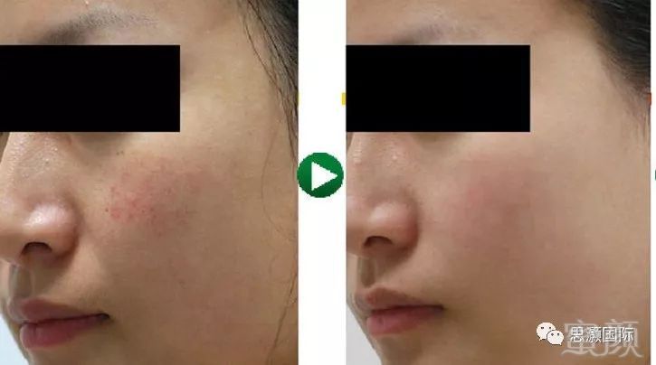 https://img.miyanlife.com/mnt/timg/191019/1139114319-7.jpg