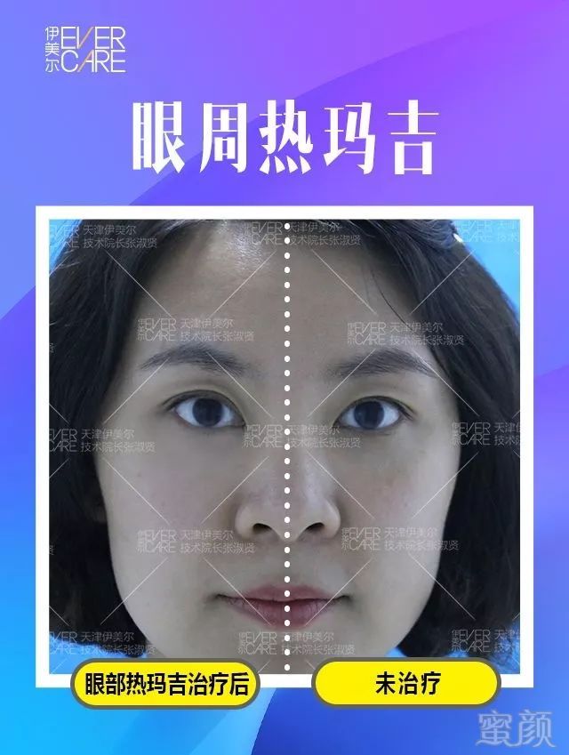 https://img.miyanlife.com/mnt/timg/191019/1159306341-3.jpg