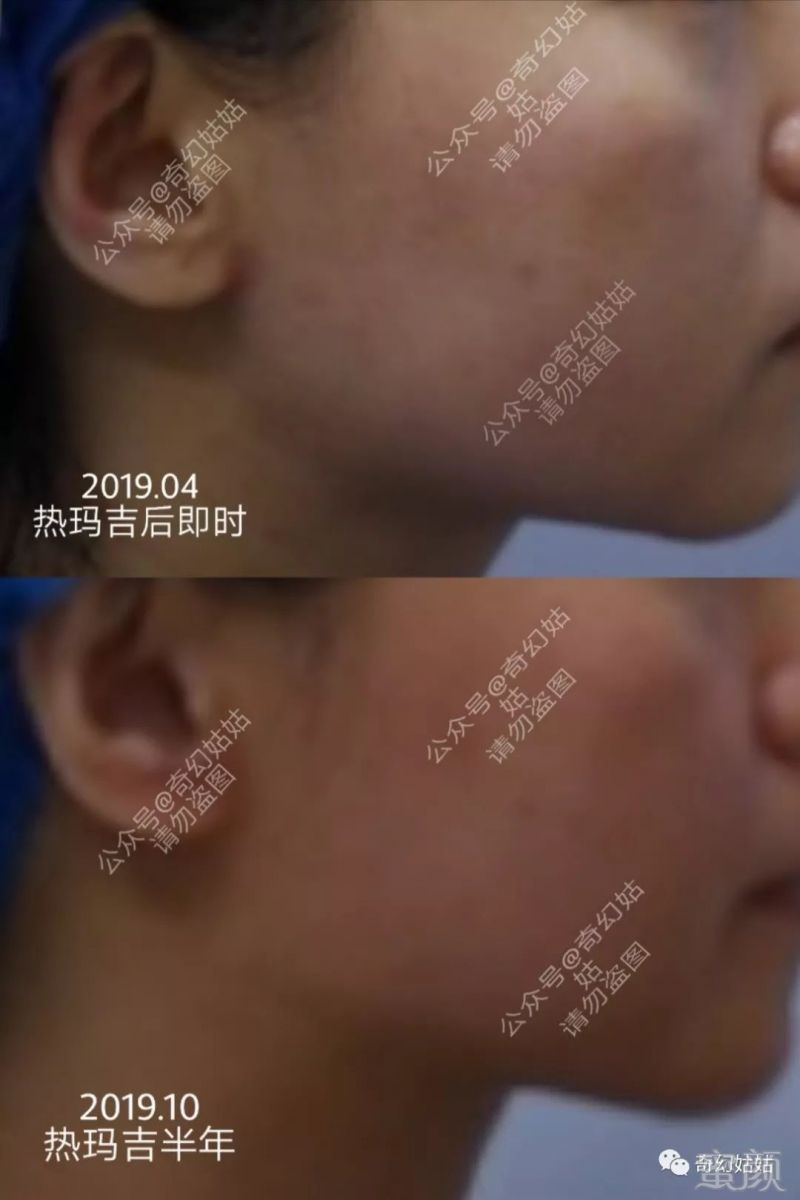 https://img.miyanlife.com/mnt/timg/191019/1203213340-0.jpg