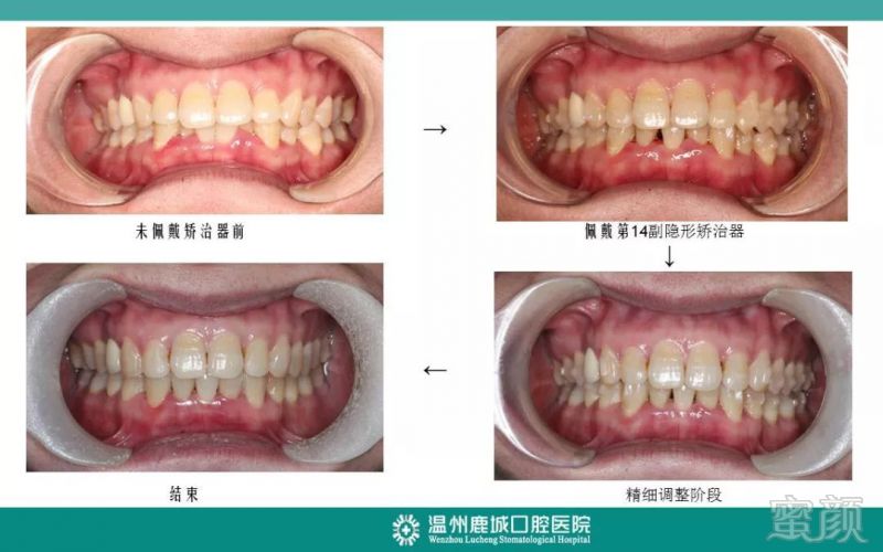 https://img.miyanlife.com/mnt/timg/191019/122T43D4-16.jpg