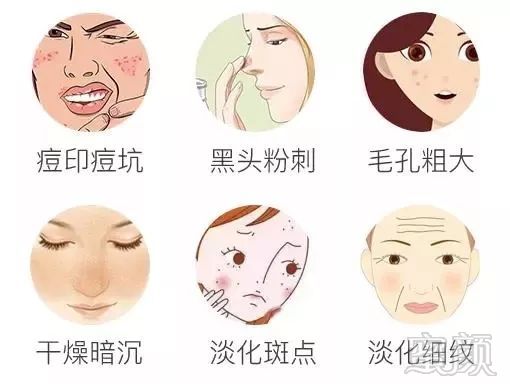 https://img.miyanlife.com/mnt/timg/191019/1250532644-7.jpg