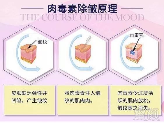 https://img.miyanlife.com/mnt/timg/191019/1255292024-3.jpg