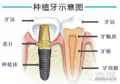 案例图片