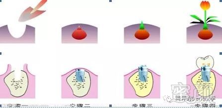 案例图片