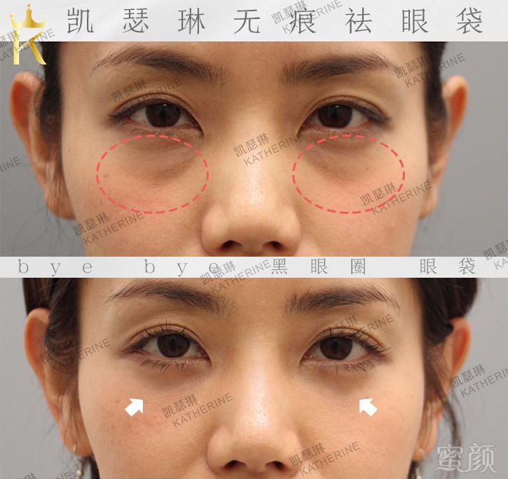 https://img.miyanlife.com/mnt/timg/191019/1300331C2-14.jpg