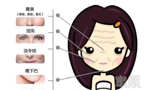 https://img.miyanlife.com/mnt/timg/191020/1304552495-6.jpg