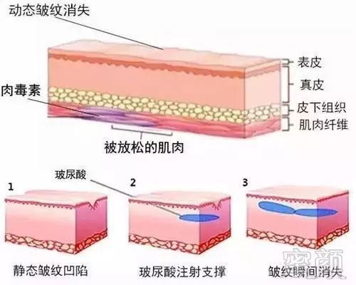 https://img.miyanlife.com/mnt/timg/191020/13045AP2-7.jpg