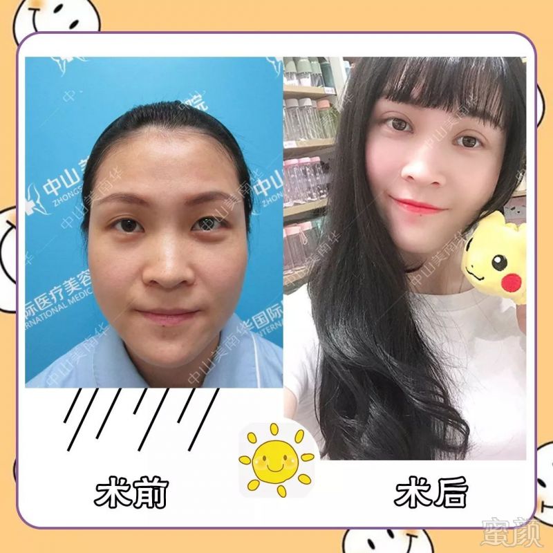 https://img.miyanlife.com/mnt/timg/191020/132Z35148-2.jpg