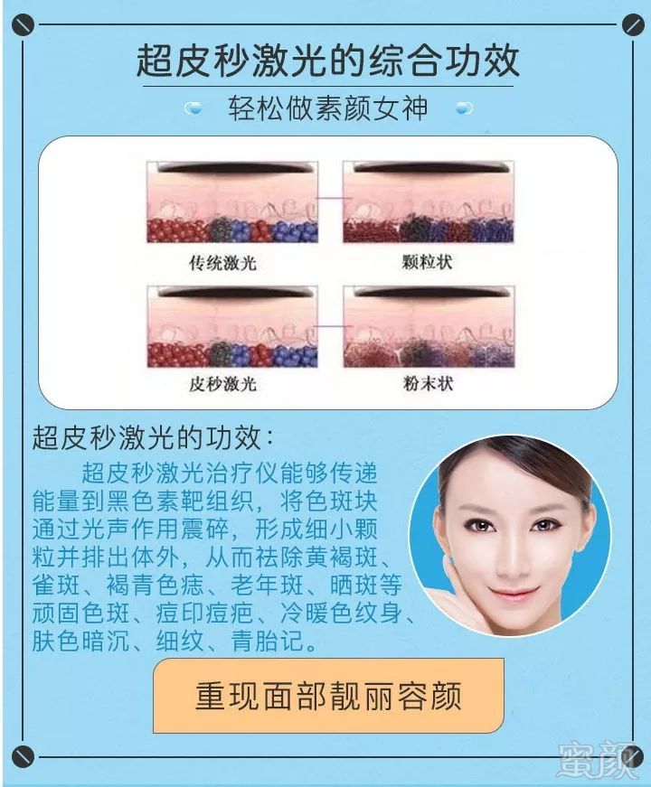 https://img.miyanlife.com/mnt/timg/191021/12000B248-7.jpg