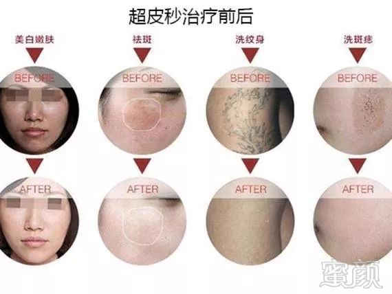 https://img.miyanlife.com/mnt/timg/191021/1200103K9-10.jpg