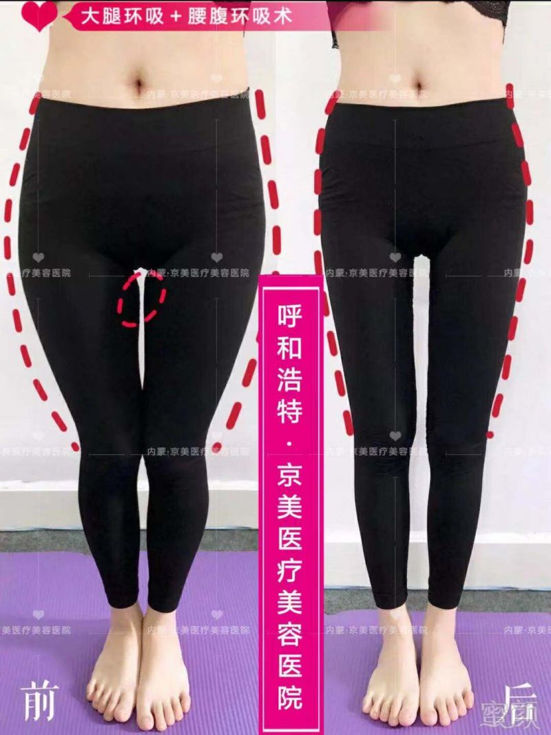 https://img.miyanlife.com/mnt/timg/191021/12394RE6-3.jpg