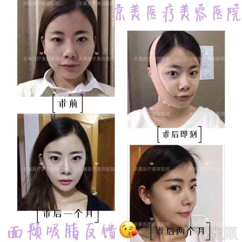 https://img.miyanlife.com/mnt/timg/191021/123951E03-6.jpg