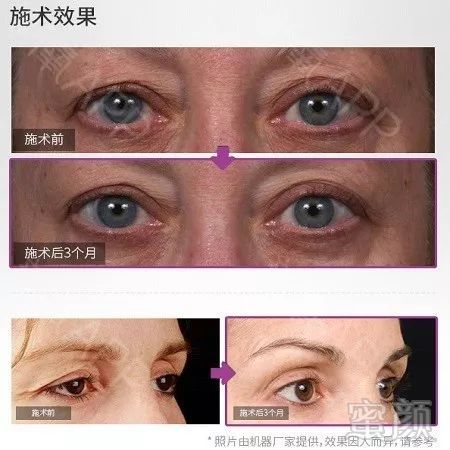 https://img.miyanlife.com/mnt/timg/191021/12421V0I-10.jpg