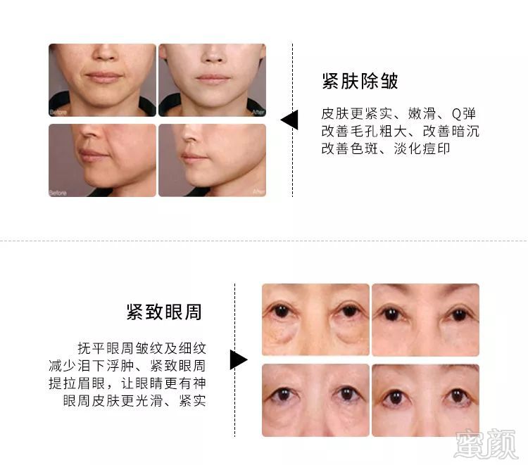 https://img.miyanlife.com/mnt/timg/191021/1244453010-4.jpg