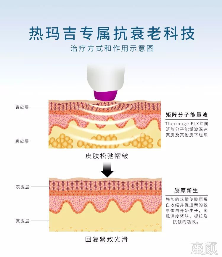 https://img.miyanlife.com/mnt/timg/191021/12444560A-3.jpg