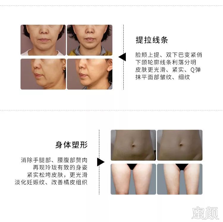 https://img.miyanlife.com/mnt/timg/191021/1244461331-5.jpg