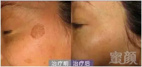 https://img.miyanlife.com/mnt/timg/191022/122U340J-5.jpg