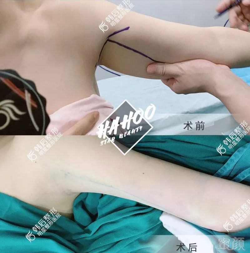 https://img.miyanlife.com/mnt/timg/191022/1256312T3-4.jpg