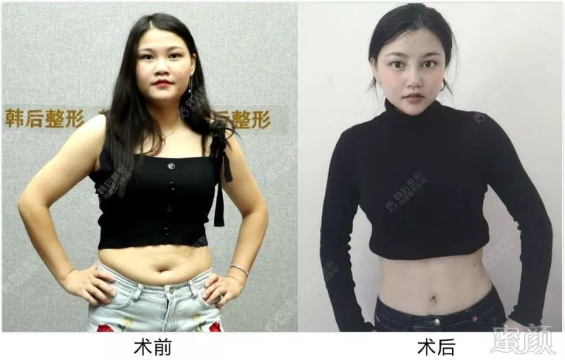 https://img.miyanlife.com/mnt/timg/191022/1256344332-6.jpg
