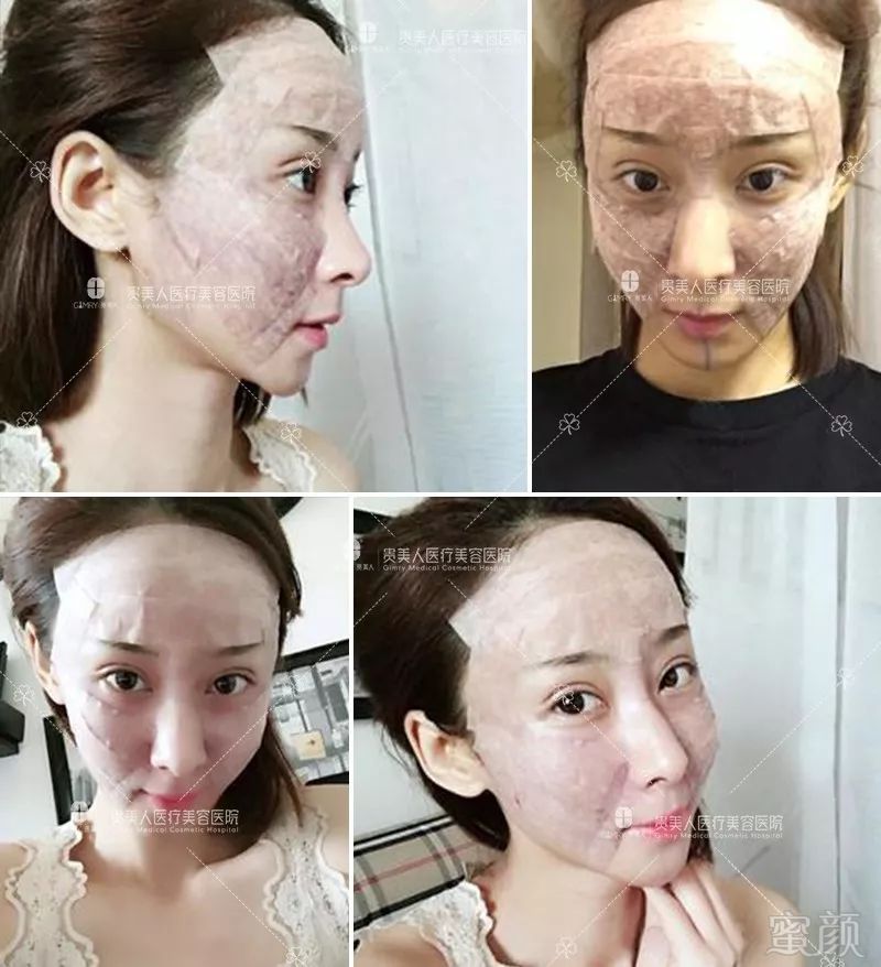 https://img.miyanlife.com/mnt/timg/191022/125Z520T-1.jpg