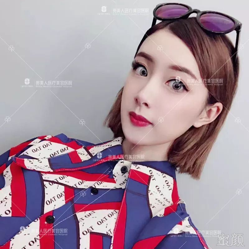 https://img.miyanlife.com/mnt/timg/191022/125Z95232-7.jpg