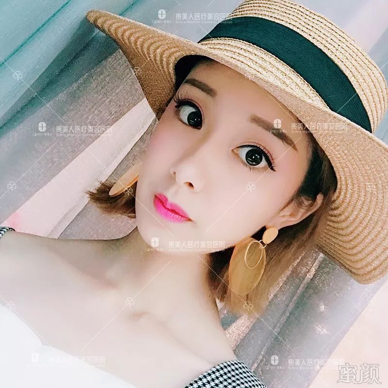 https://img.miyanlife.com/mnt/timg/191022/125ZVc4-5.jpg