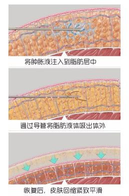 https://img.miyanlife.com/mnt/timg/191023/12563B946-4.jpg