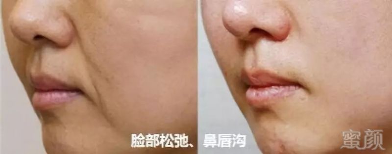 https://img.miyanlife.com/mnt/timg/191023/12593L954-3.jpg