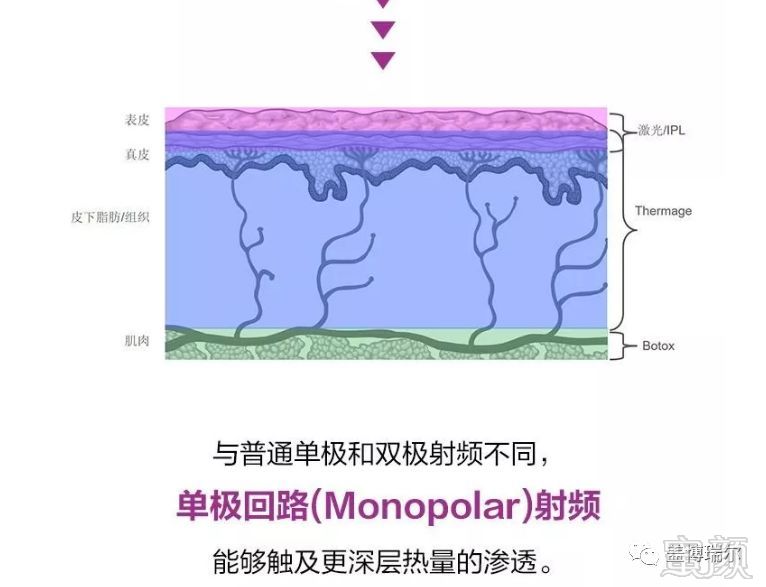 https://img.miyanlife.com/mnt/timg/191023/125S03010-7.jpg