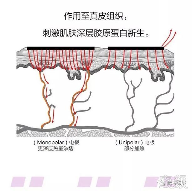https://img.miyanlife.com/mnt/timg/191023/125S13E6-8.jpg