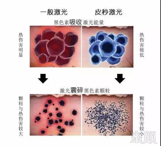 https://img.miyanlife.com/mnt/timg/191023/13024a222-3.jpg