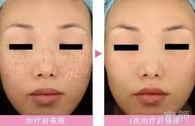 https://img.miyanlife.com/mnt/timg/191023/1302501J3-5.jpg