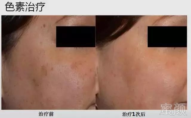 https://img.miyanlife.com/mnt/timg/191023/13025125L-8.jpg