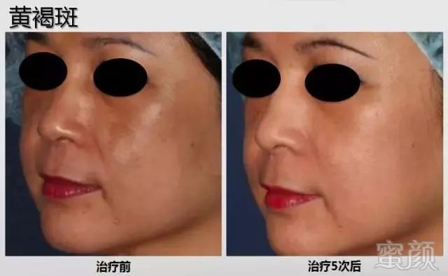 https://img.miyanlife.com/mnt/timg/191023/130251Gc-7.jpg