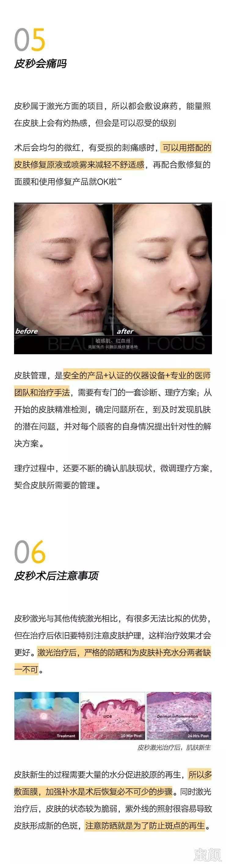 https://img.miyanlife.com/mnt/timg/191023/1304044G0-9.jpg
