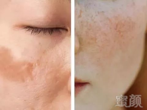 https://img.miyanlife.com/mnt/timg/191023/13143J030-3.jpg