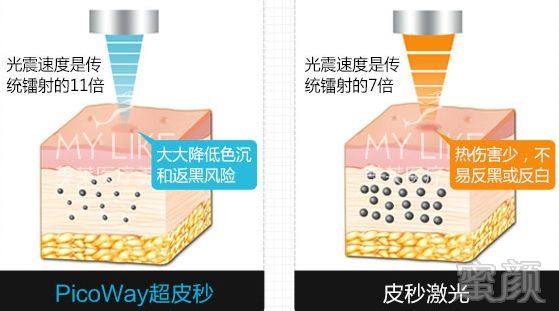 https://img.miyanlife.com/mnt/timg/191023/1314462595-15.jpg