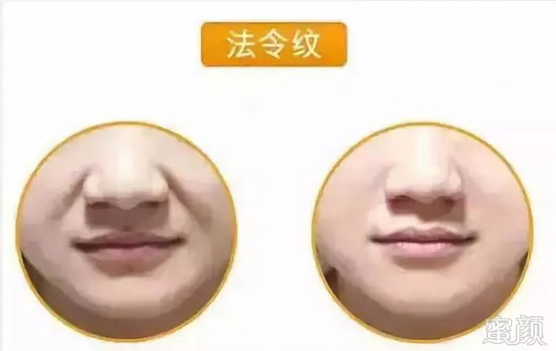 https://img.miyanlife.com/mnt/timg/191023/1329553093-4.jpg