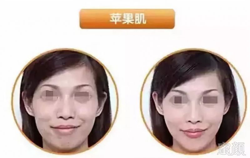 https://img.miyanlife.com/mnt/timg/191023/1329553393-5.jpg