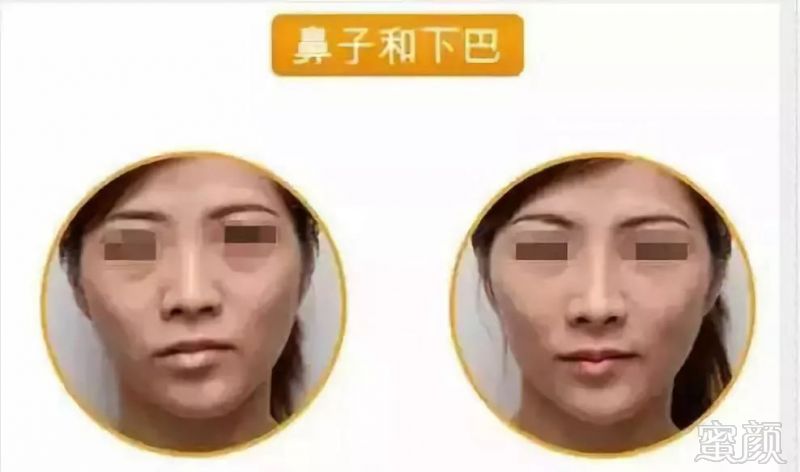 https://img.miyanlife.com/mnt/timg/191023/1329561361-6.jpg